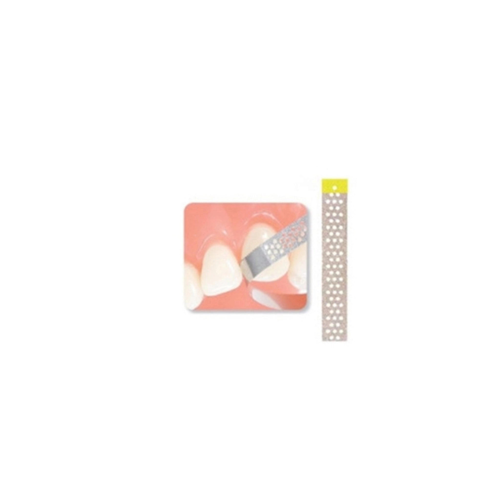 A perforated diamond finishing strip with a yellow-coded handle used for precise interproximal reduction. The image shows the strip in action during enamel contouring between two front teeth, demonstrating its application for achieving smooth tooth surfaces.