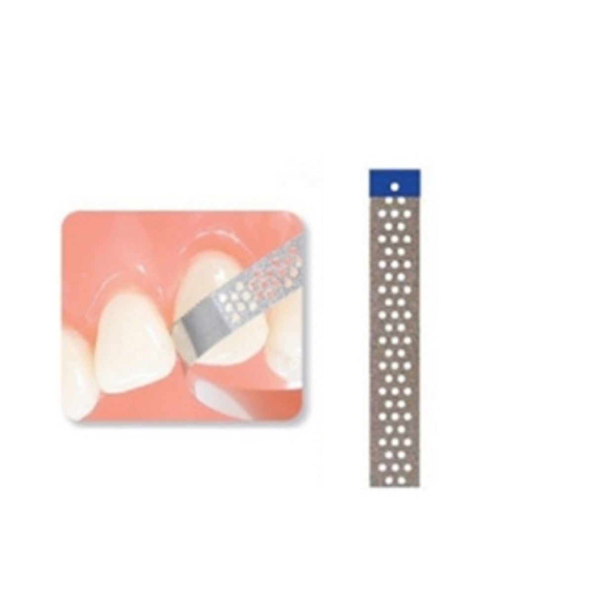 A perforated diamond finishing strip with a blue-coded handle designed for effective enamel shaping and contouring. The strip is displayed being used for precise interproximal adjustments between two teeth, ensuring accessibility and control.